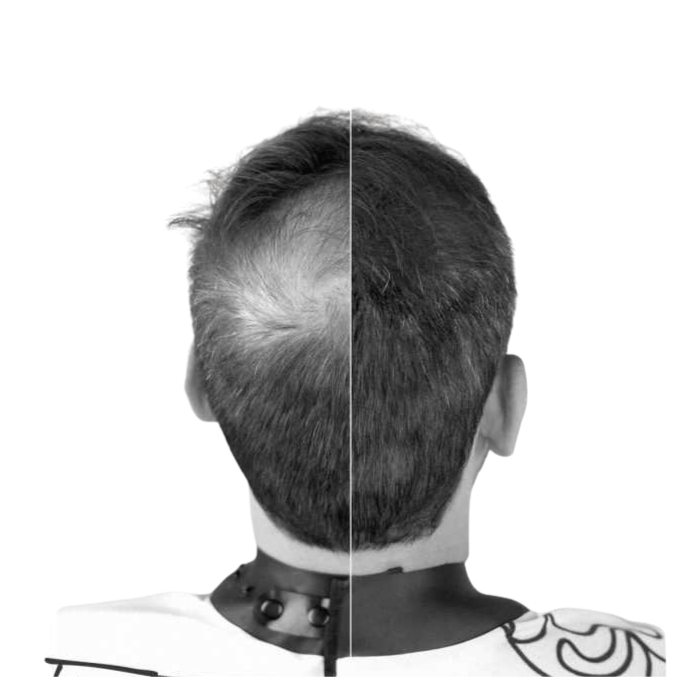 Immortal NYC Kit Fibras Capilares + Spray Fixador Castanho Escuro 22 g + 100 ml